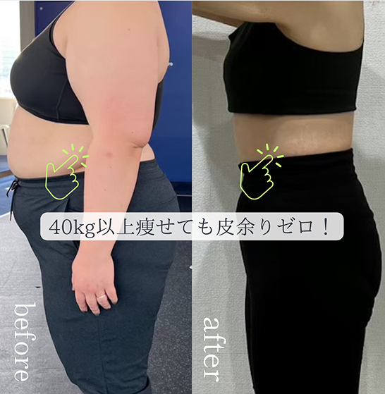 ダイエットで皮余りせず痩せた女性