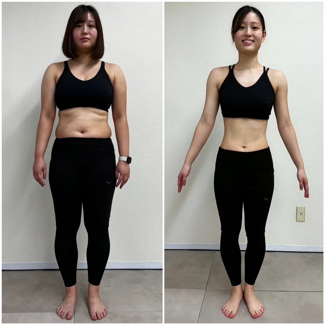 3ヶ月で-18kg以上痩せた20代女性のビフォーアフター 正面