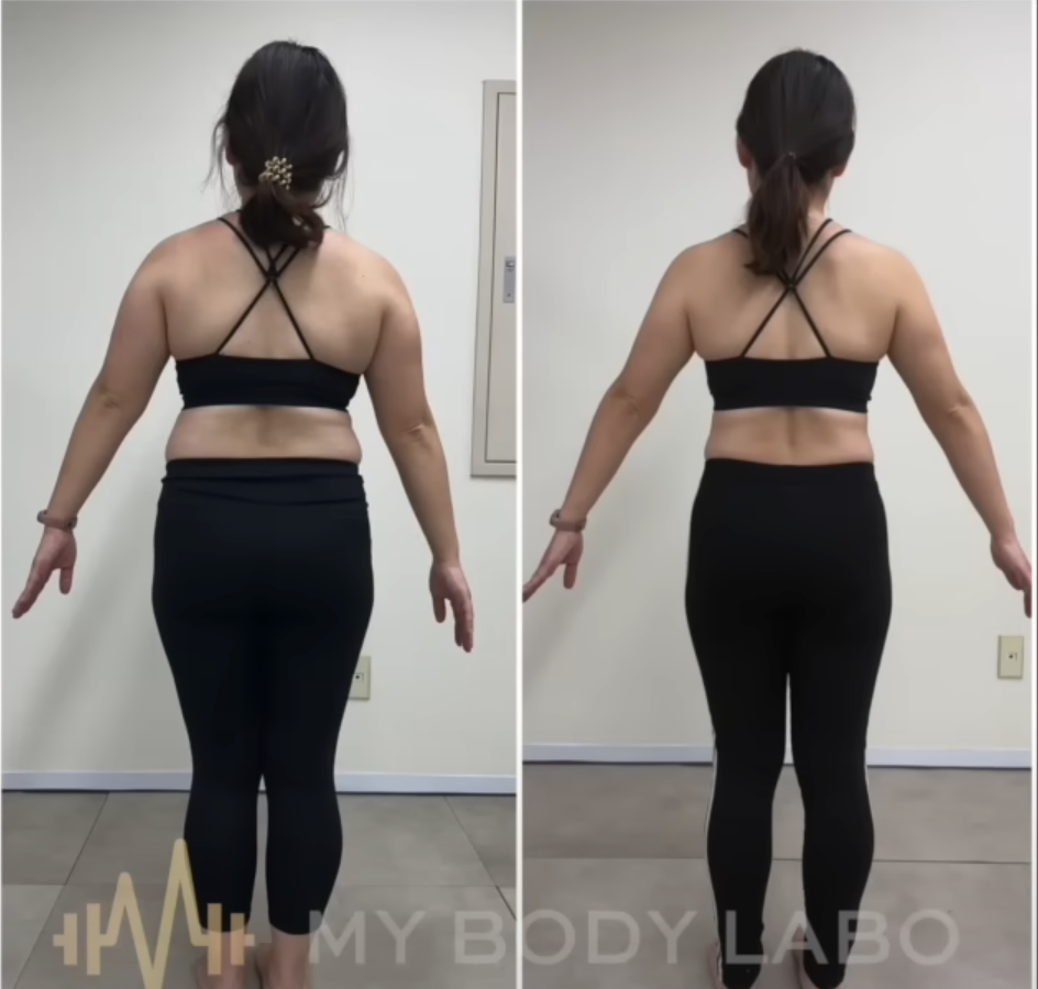 30代女性が-10kg以上痩せたビフォーアフター 後ろ姿