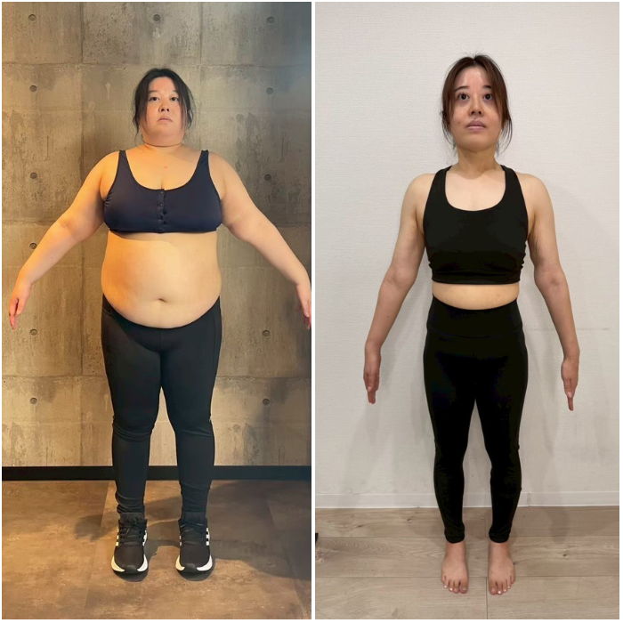 90キロ女性がダイエットで痩せたビフォーアフター　正面