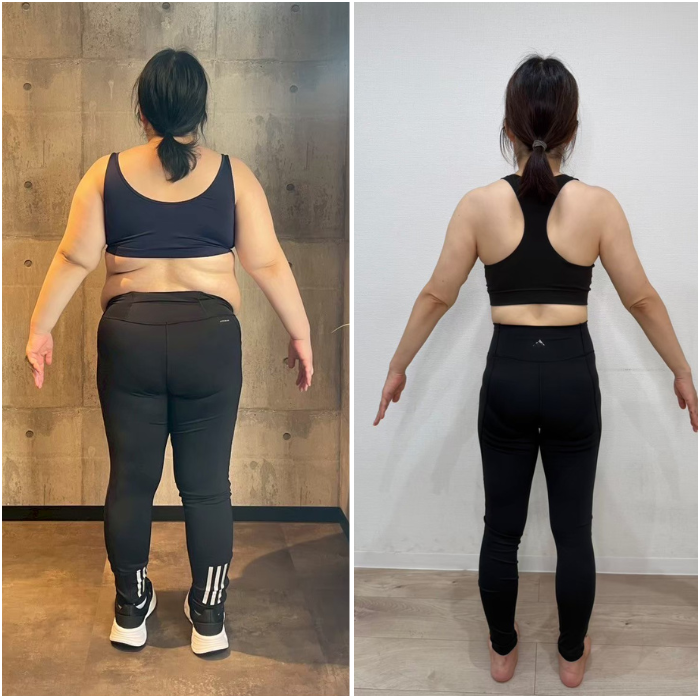 90キロ女性がダイエットで痩せたビフォーアフター　背中